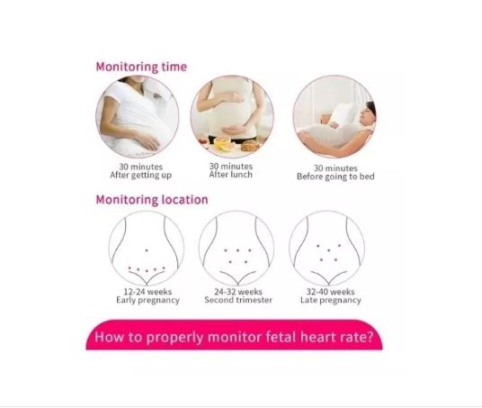 MONITOR FETAL DOPPLER LATIDOS